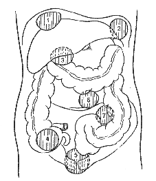 места локализации абсцессов брюшной полости